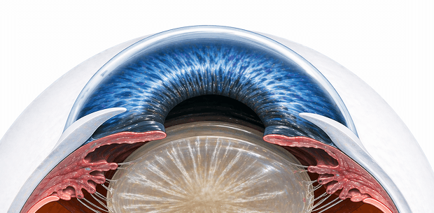 cataract eye image
